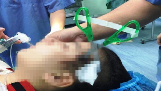 Hãi hùng bé gái 10 tuổi bị kéo đâm thủng sọ