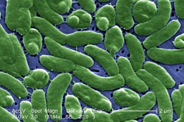 vi-khuan-vibrio-vulnificus-ngoisao.vn-w700-h510.jpg 1