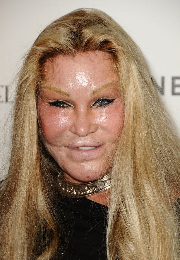 Jocelyn Wildenstein - từ xuất thân danh giá xinh đẹp đến thảm họa thẩm mỹ  nợ nần