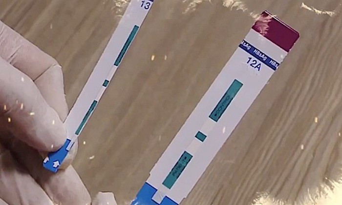 Lập đoàn thanh tra vụ cắt đôi test xét nghiệm HIV, viêm gan B tại Bệnh viện Xanh Pôn
