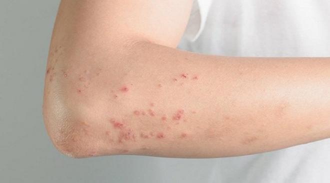 1-hiv-aids-ngoisao.vn-w800-h444 4