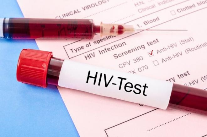 5-hiv-aids-ngoisao.vn-w800-h529 0