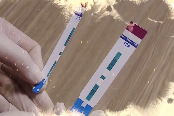 vu-cat-doi-que-thu-hiv-o-bv-xanh-pon-se-dieu-tra-neu-co-dau-hieu-hinh-su-w600-h400.jpg