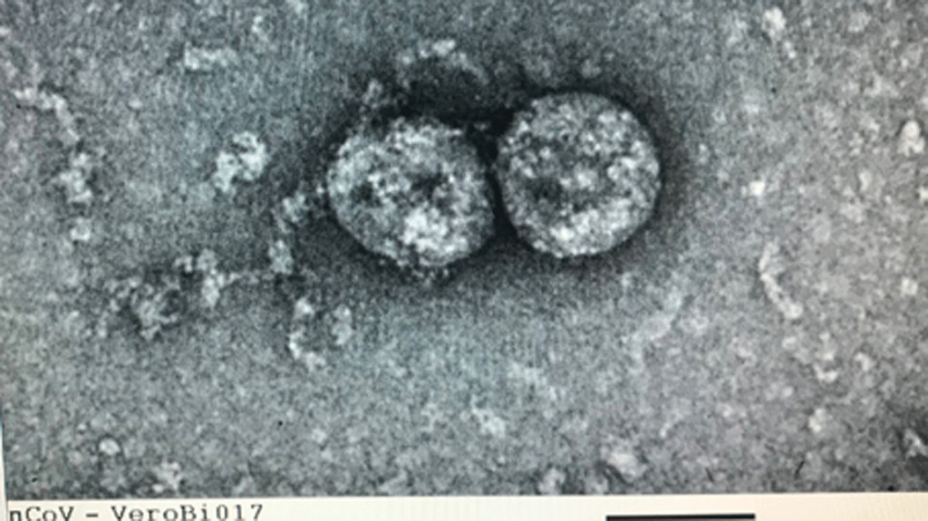 Virus SARS-CoV-2 tại Việt Nam gồm 2 nhánh khác nhau