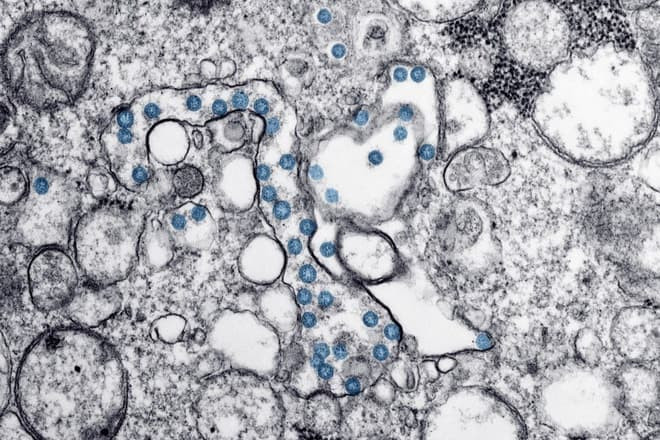 virus-corona.jpg 0