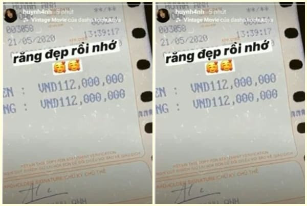 Trở thành tình mới của Quang Hải chưa lâu, Huỳnh Anh bỏ trăm triệu làm răng, trùng tu nhan sắc 4