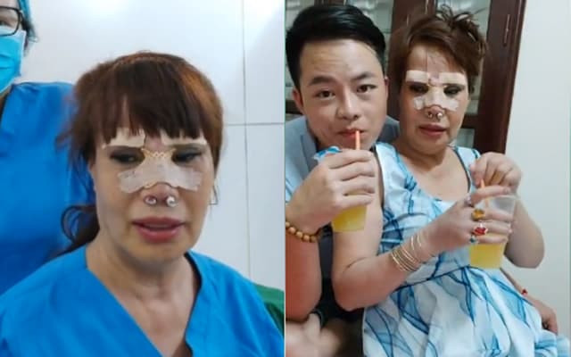 Thu Sao căng da mặt 2