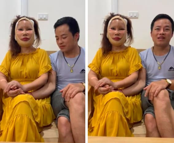 Thu Sao căng da mặt 3