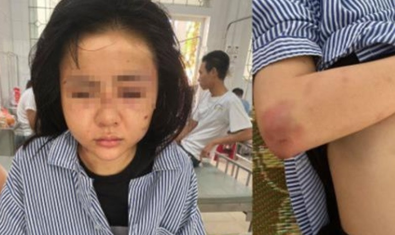 Yên Bái: Khởi tố kẻ đánh đập cô gái suốt 2 giờ đồng hồ