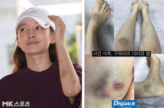 Goo Hara qua đời được chưa lâu, bạn trai cũ lập tức kháng cáo tội hành hung gây phẫn nộ 0