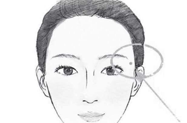 nốt ruồi 2