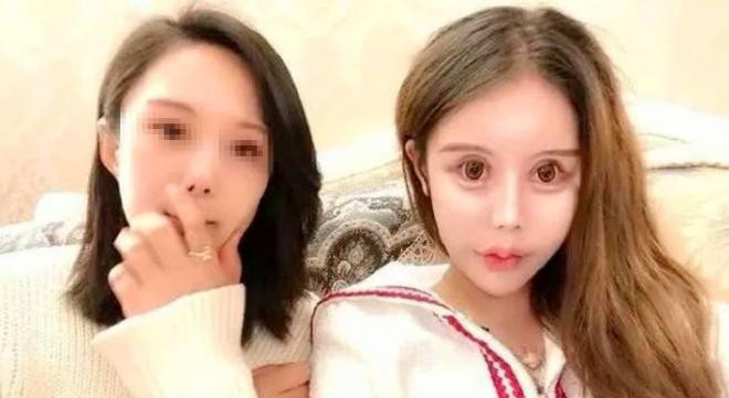phẫu thuật thẩm mỹ 1