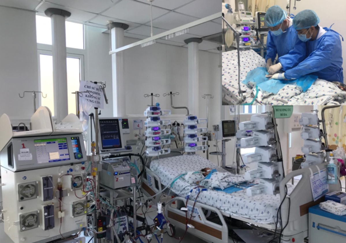 Bé 4 ngày tuổi mắc bệnh tim bẩm sinh hồi sinh nhờ ECMO