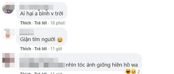 Trịnh Thăng Bình sửa mũi  2