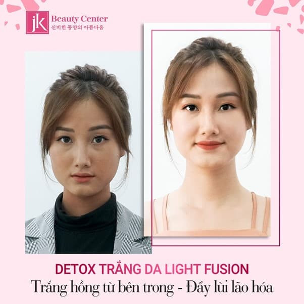 lam-trang-da-1111-6-ngoisaovn-w602-h601 1 lam-trang-da-1111-6-ngoisaovn-w602-h601 1