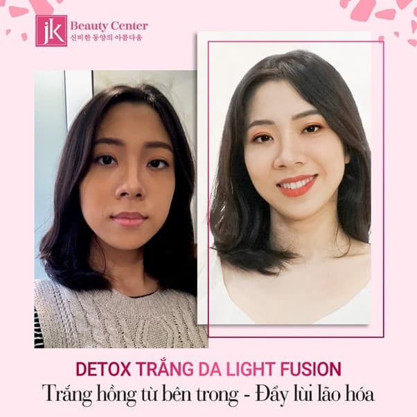 lam-trang-da-1111-7-ngoisaovn-w602-h601 0 lam-trang-da-1111-7-ngoisaovn-w602-h601 0