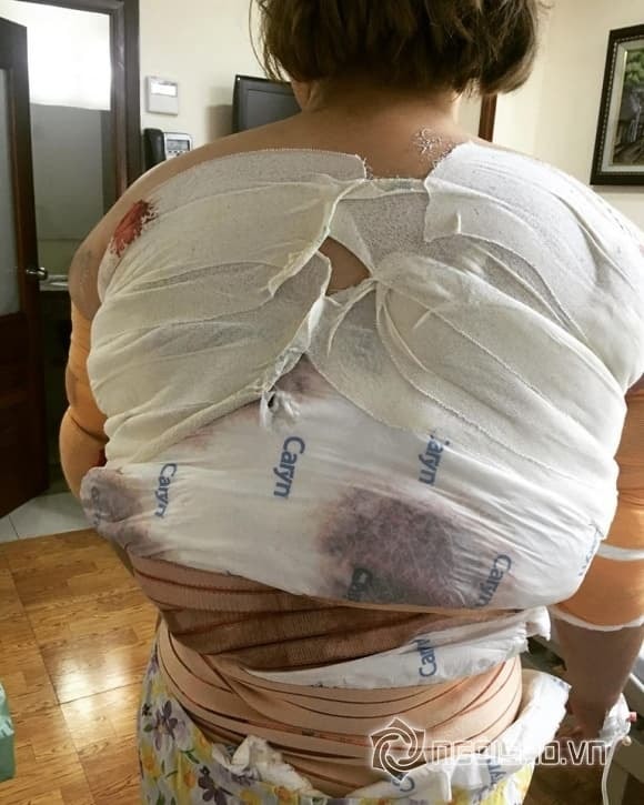 Ngô Thủy Tiên giảm cân 0 Ngô Thủy Tiên giảm cân 0