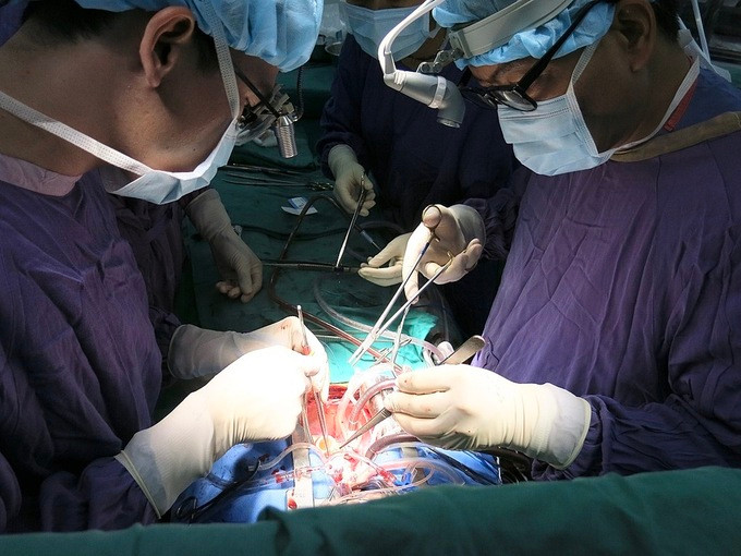 Bác sĩ Bệnh viện Việt Đức thực hiện ghép tim cho 2 bệnh nhân trong 2 ngày liên tiếp. Ảnh:Bệnh viện cung cấp