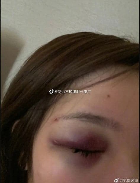 sao nam Hậu cung như ý truyện bị tố bạo hành 0