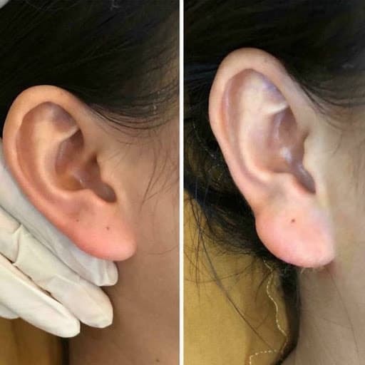 Nữ doanh nhân vào spa làm 'tai Phật' để cải thiện tướng số, đổi vận đâu chưa thấy đã nhận lấy 'trái đắng' 7