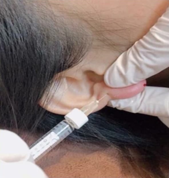 Nữ doanh nhân vào spa làm 'tai Phật' để cải thiện tướng số, đổi vận đâu chưa thấy đã nhận lấy 'trái đắng' 3