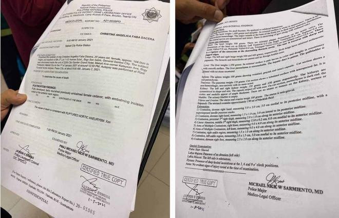 Vụ Á hậu Philippines: Cảnh sát trưởng xác nhận nạn nhân tử vong do tấn công tình dục bất ngờ bị cách chức 3