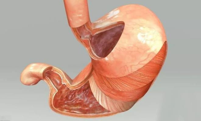 Không muốn bị bệnh dạ dày, bốn loại thực phẩm dù thích ăn cũng nên tránh 0
