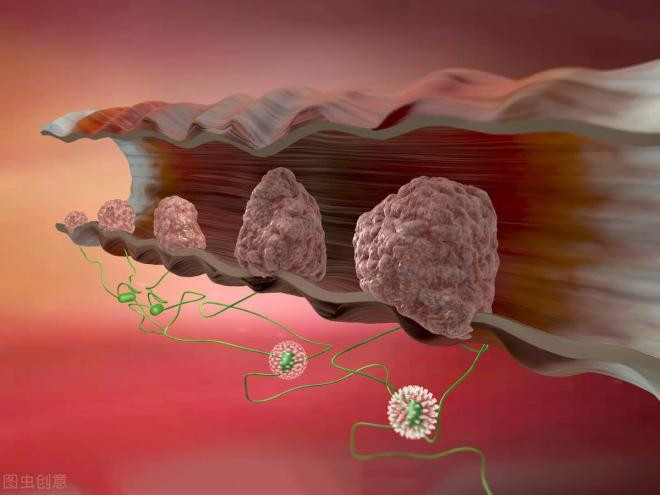 polyp-ruot (1).jpg 0 polyp-ruot (1).jpg 0
