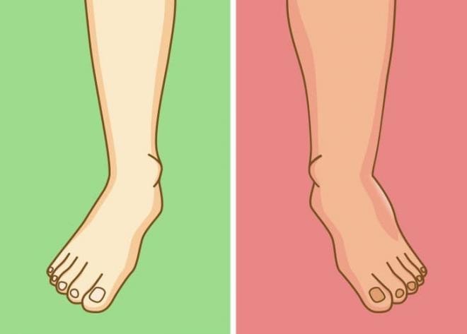 tác hại của việc ngồi vắt chéo chân   1