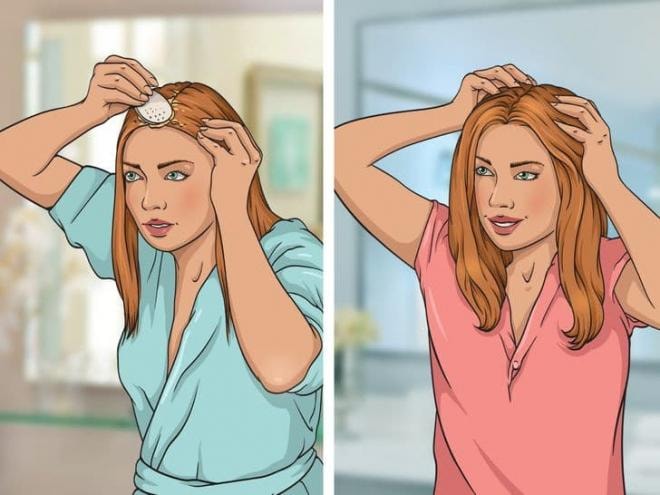 kích thích mọc tóc  6
