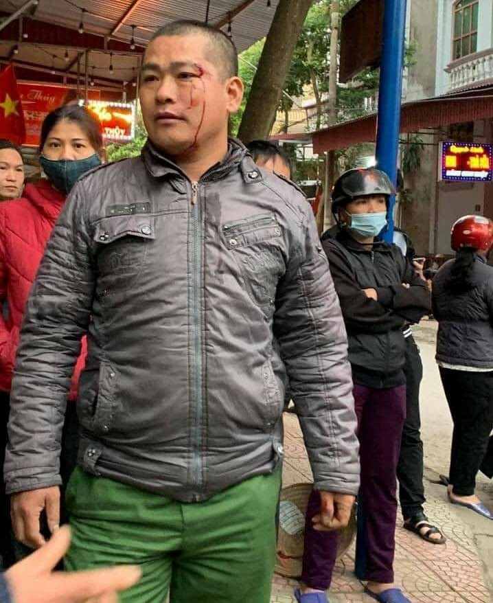 anh2.jpg