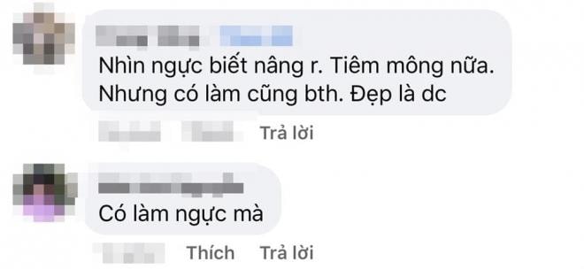 Anh Thư nâng ngực  3