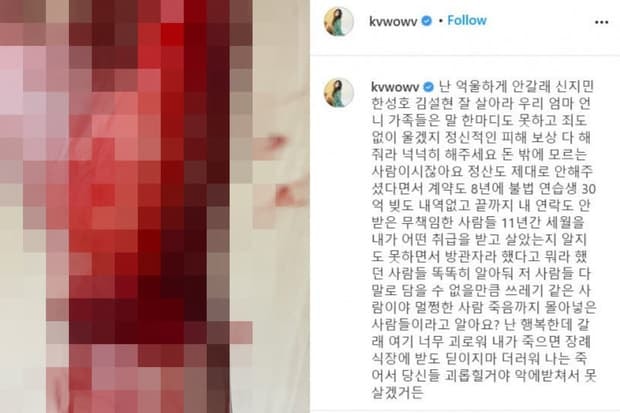 Kwon Mina tự tử tại nhà riêng sau khi tố chị em cùng nhóm bắt nạt, netizen chia 2 phe xót xa và mỉa 'làm màu' vì nguyên nhân này  7