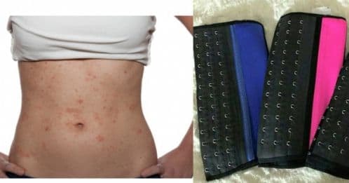 đeo gen nit bụng 7