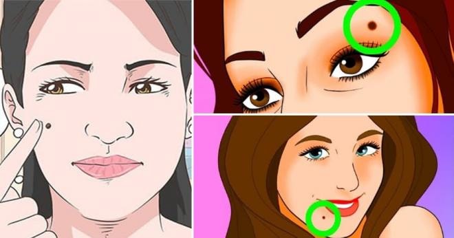 những vị trí nốt ruồi trên mặt 4