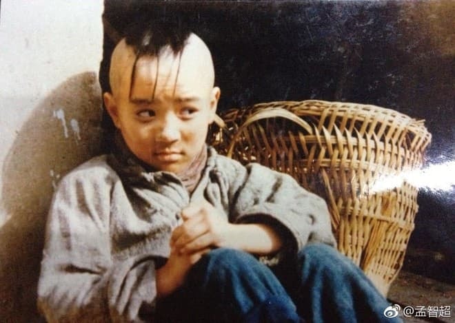 Cậu bé 'Tam Mao' đã trưởng thành, nhiều năm bị thương da đầu đến không thể mọc tóc, sau 25 năm vẫn độc thân 1