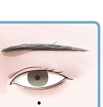 not-ruoi-mat (1).jpg 2