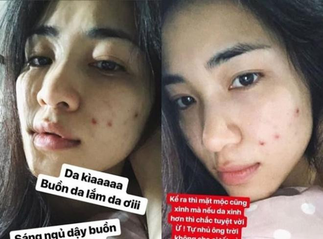 Hòa Minzy chăm sóc da  5