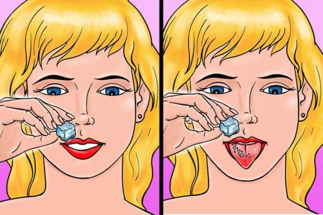 chữa lành vết bỏng rát lưỡi 9 chữa lành vết bỏng rát lưỡi 9