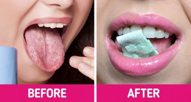 chữa lành vết bỏng rát lưỡi 1 chữa lành vết bỏng rát lưỡi 1