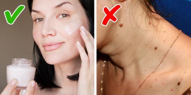 cách ngăn ngừa mụn cóc  3