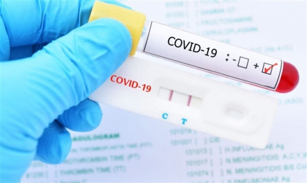 Bộ Y tế ban hành giá xét nghiệm COVID-19 mới: Giảm 30% so với trước - 1