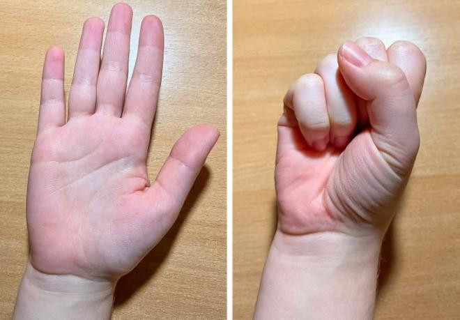 cách loại bỏ cảm xúc lo lắng  2