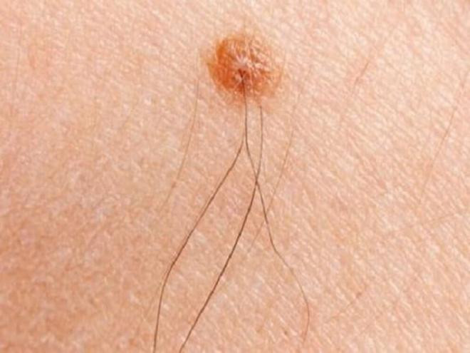 dau-hieu-may-man-33-1.jpg 0 dau-hieu-may-man-33-1.jpg 0