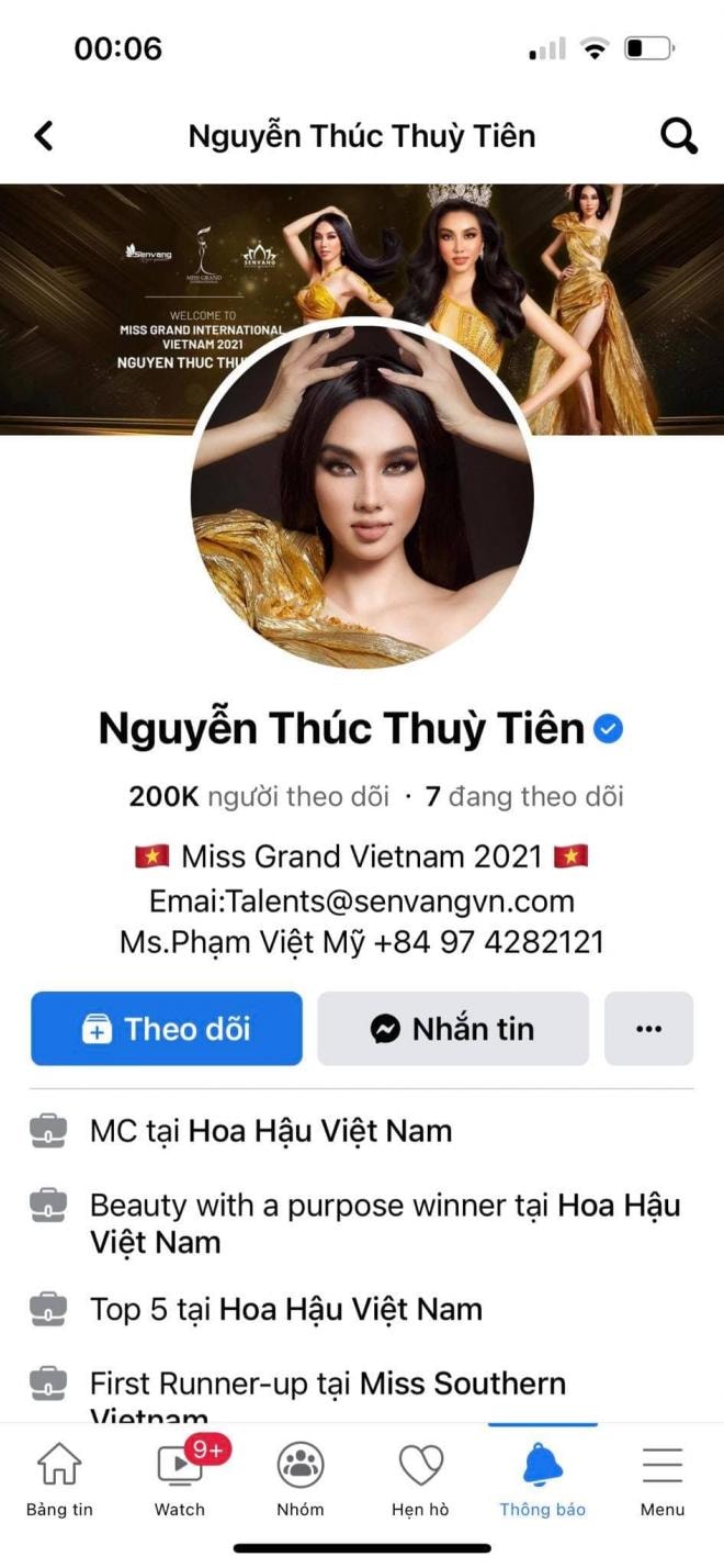 phau-thuat-sao-thuy-tien-doi-doi-ra-sao-sau-khi-dang-quang-miss-grand-international-2021-21-ngoisaovn-w946-h2048 5