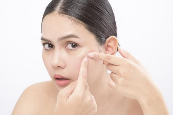 cách trị mụn 1 cách trị mụn 1