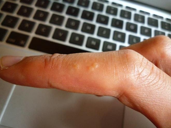 mun-ngua (1).jpg 0