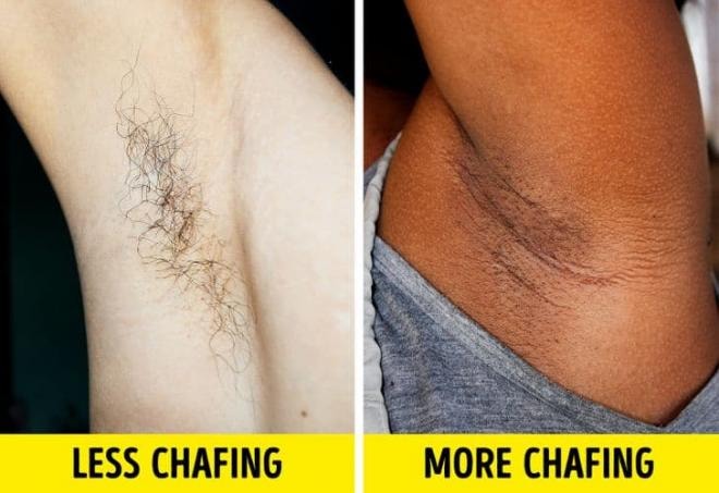 phụ nữ ngừng cạo lông trên cơ thể  3