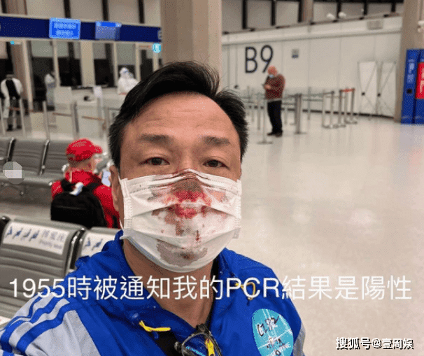Sao Hong Kong 54 tuổi chảy máu mũi đầm đìa vì bị chọc dụng cụ quá mạnh khi đi test Covid-19, đến khi nhân viên y tế biến mất vẫn còn choáng váng 2