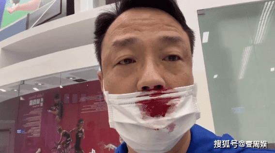 Sao Hong Kong 54 tuổi chảy máu mũi đầm đìa vì bị chọc dụng cụ quá mạnh khi đi test Covid-19, đến khi nhân viên y tế biến mất vẫn còn choáng váng 1